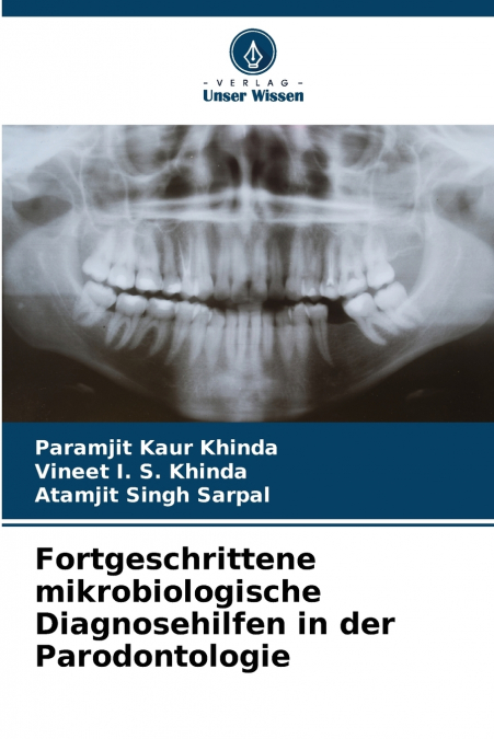 FORTGESCHRITTENE MIKROBIOLOGISCHE DIAGNOSEHILFEN IN DER PARO
