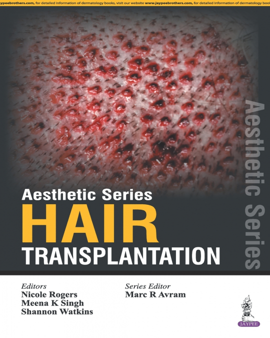 AESTHETIC SERIES-HAIR TRANSPLANTATION