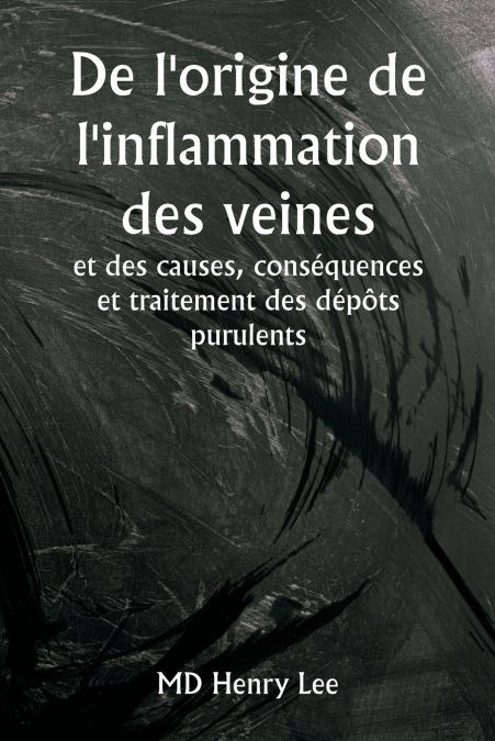 DE L?ORIGINE DE L?INFLAMMATION DES VEINES ET DES CAUSES, CON