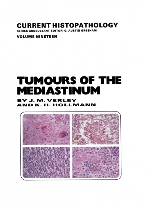 TUMOURS OF THE MEDIASTINUM