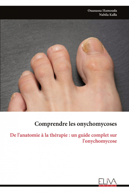 COMPRENDRE LES ONYCHOMYCOSES
