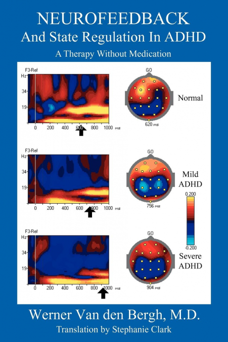 Neurofeedback and State Regulation in ADHD