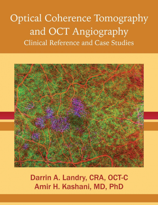 Optical Coherence Tomography and OCT Angiography