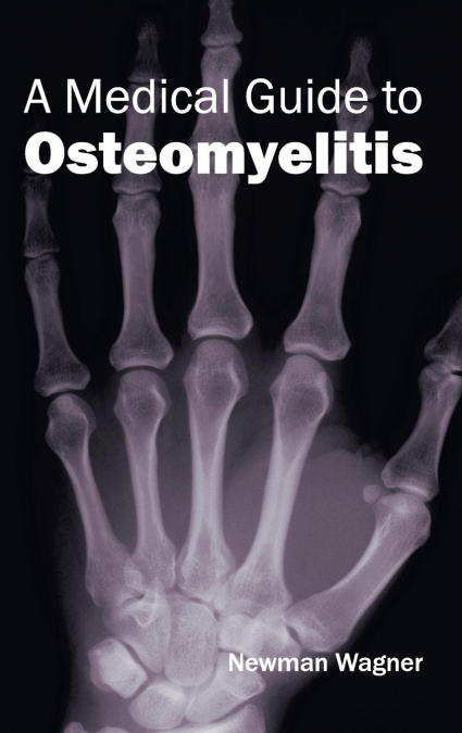 A Medical Guide to Osteomyelitis