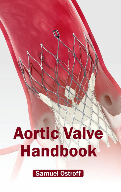 Aortic Valve Handbook