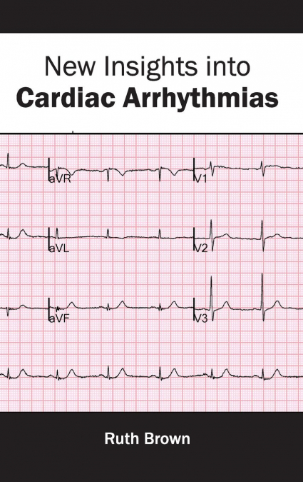 New Insights into Cardiac Arrhythmias