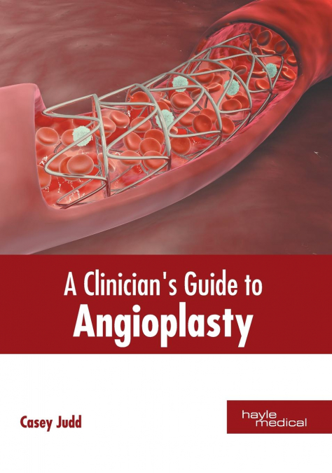 A Clinician’s Guide to Angioplasty
