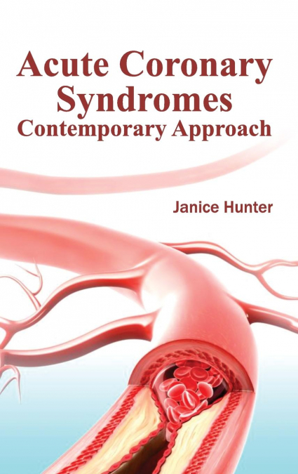 Acute Coronary Syndromes