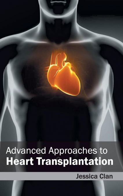 Advanced Approaches to Heart Transplantation