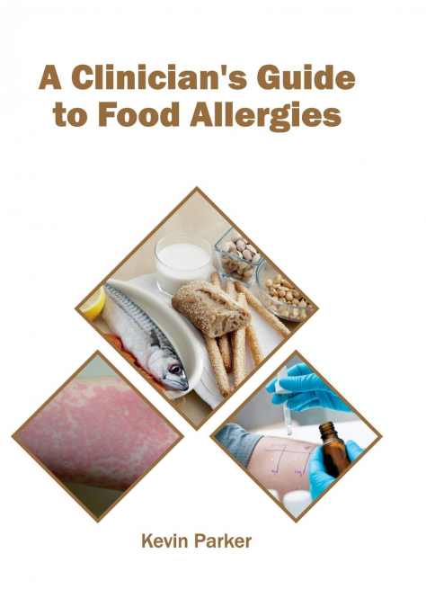 A Clinician’s Guide to Food Allergies