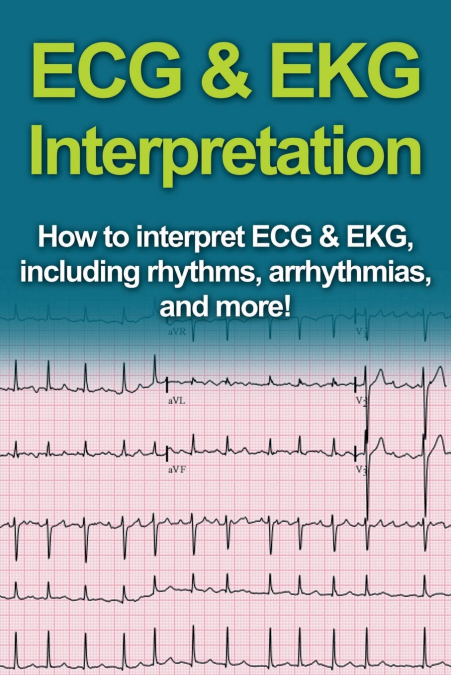 ECG & EKG Interpretation
