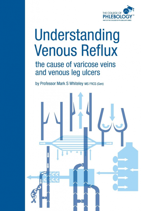 Understanding Venous Reflux the Cause of Varicose Veins and Venous Leg Ulcers