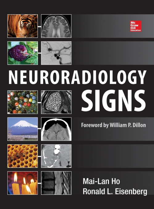 Neuroradiology Signs