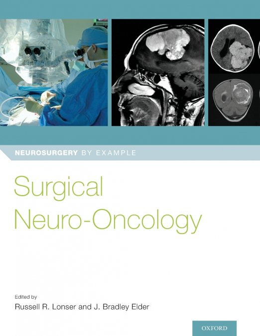 Surgical Neuro-Oncology