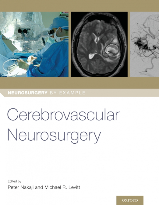 Cerebrovascular Neurosurgery