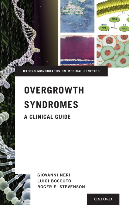 Overgrowth Syndromes