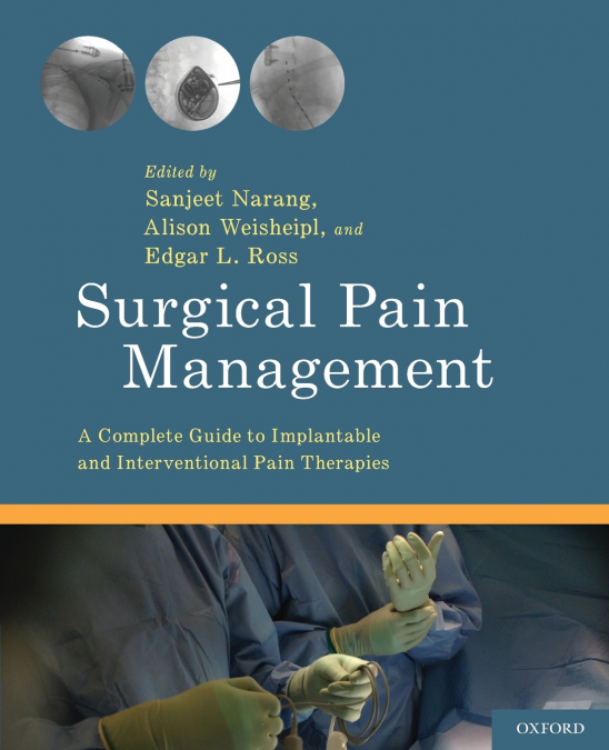 Surgical Pain Management