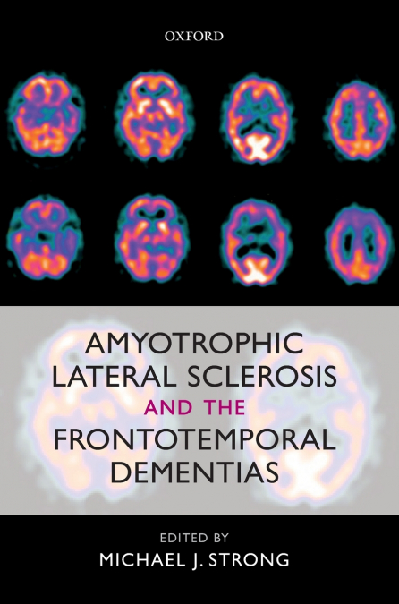 Amyotrophic Lateral Sclerosis and the Frontotemporal Dementias