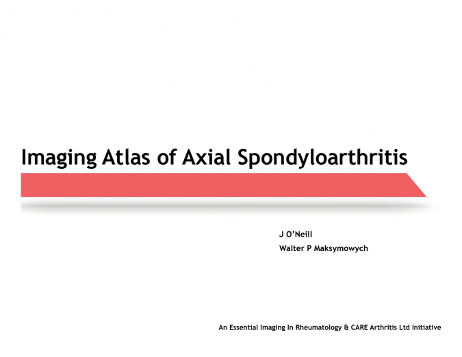 Imaging Atlas of Axial Spondyloarthritis