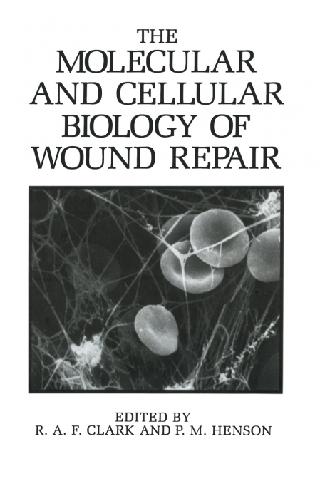The Molecular and Cellular Biology of Wound Repair