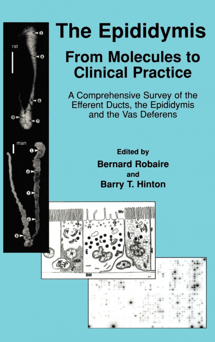 The Epididymis