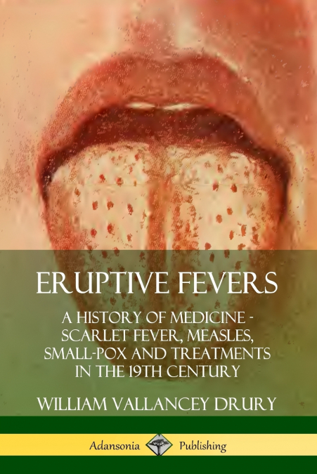 Eruptive Fevers
