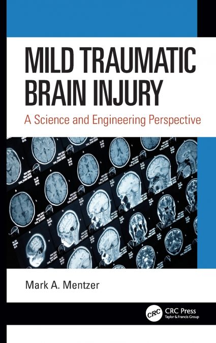 Mild Traumatic Brain Injury