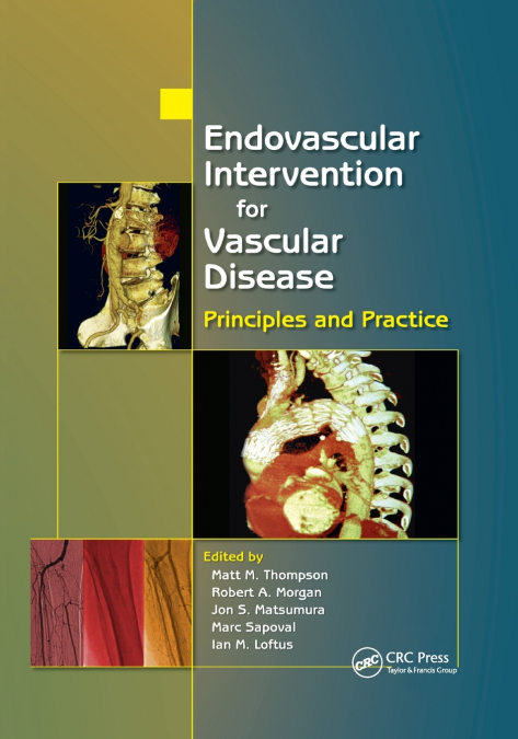 Endovascular Intervention for Vascular Disease