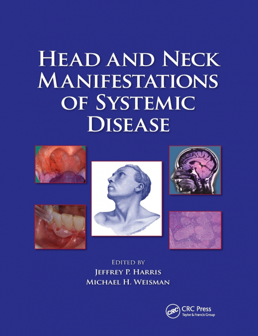Head and Neck Manifestations of Systemic Disease