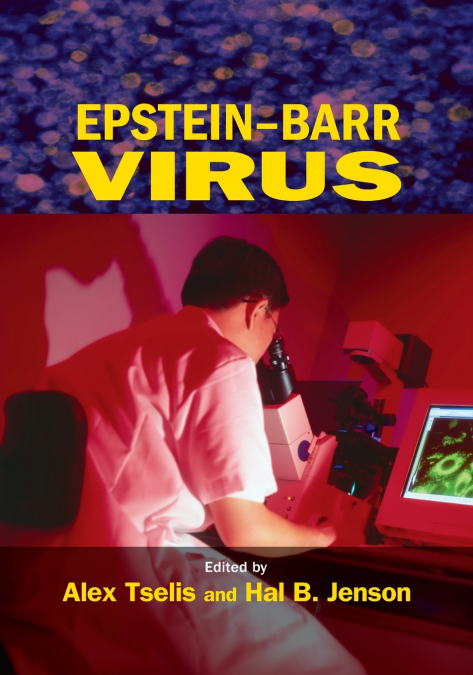 Epstein-Barr Virus