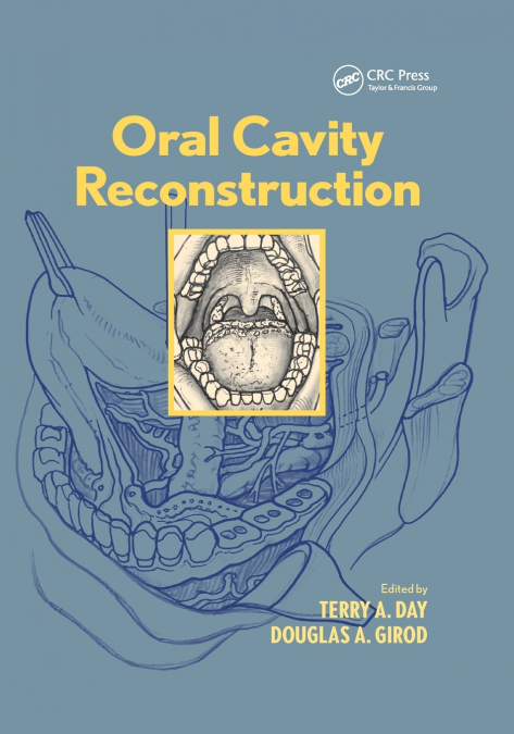 Oral Cavity Reconstruction