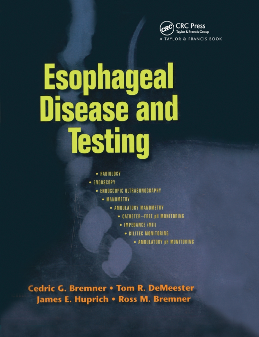 Esophageal Disease and Testing