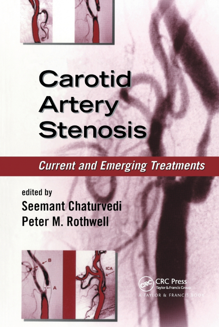 Carotid Artery Stenosis