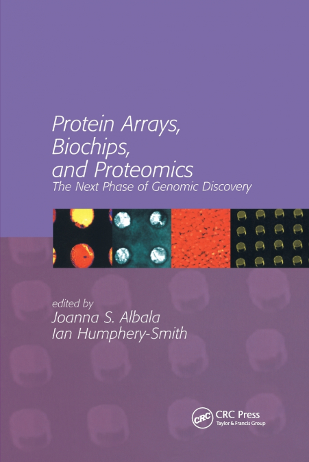 Protein Arrays, Biochips and Proteomics