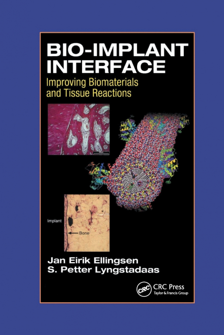 Bio-Implant Interface