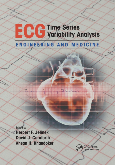 ECG Time Series Variability Analysis