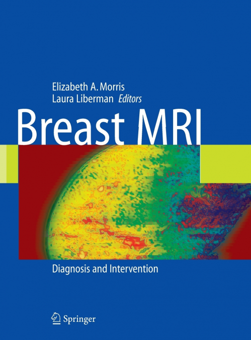 Breast MRI