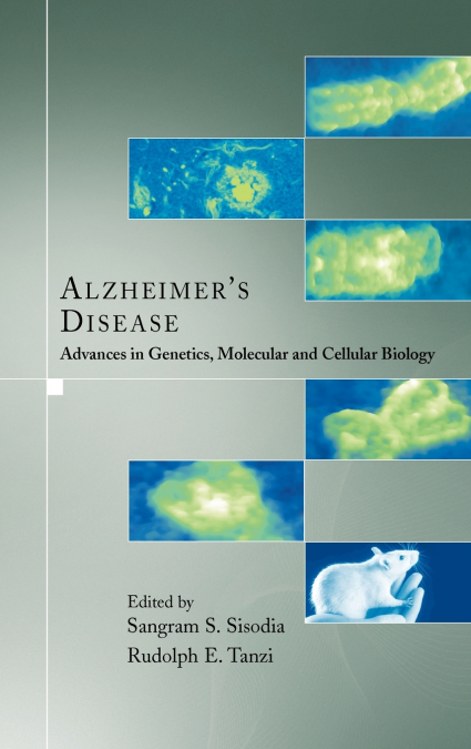 Alzheimer’s Disease