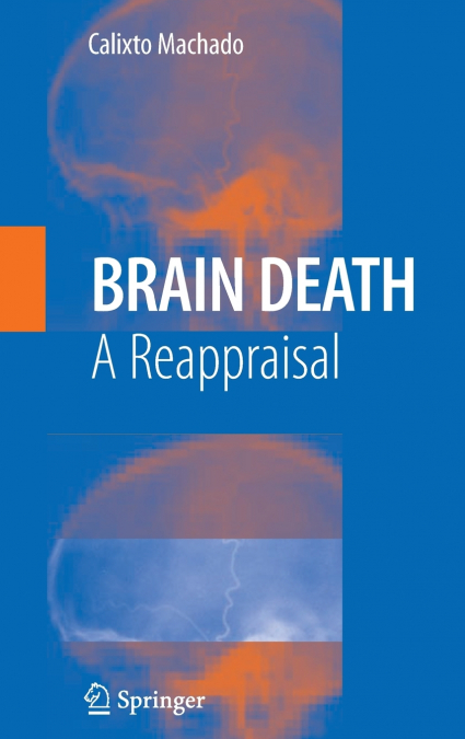 Brain Death
