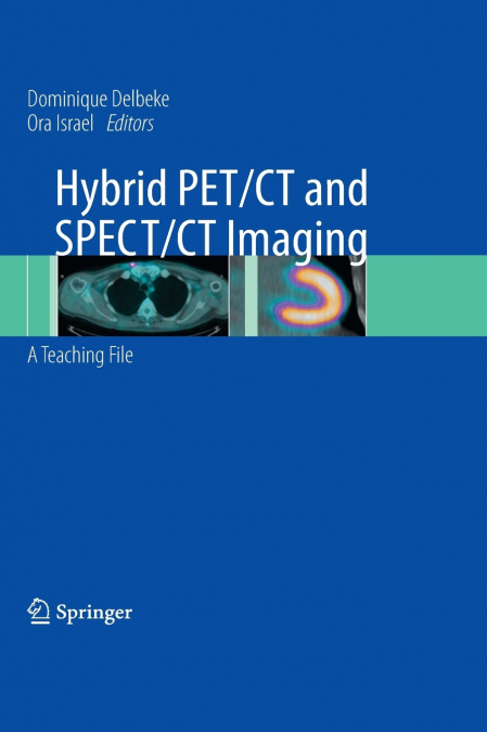 Hybrid PET/CT and SPECT/CT Imaging