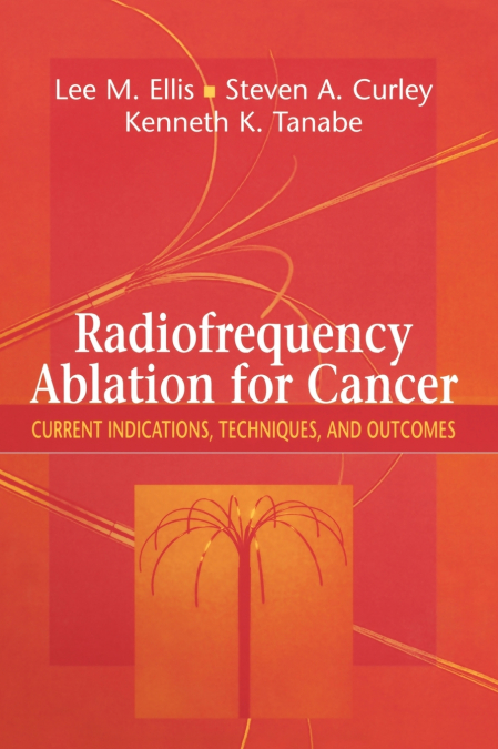 Radiofrequency Ablation for Cancer