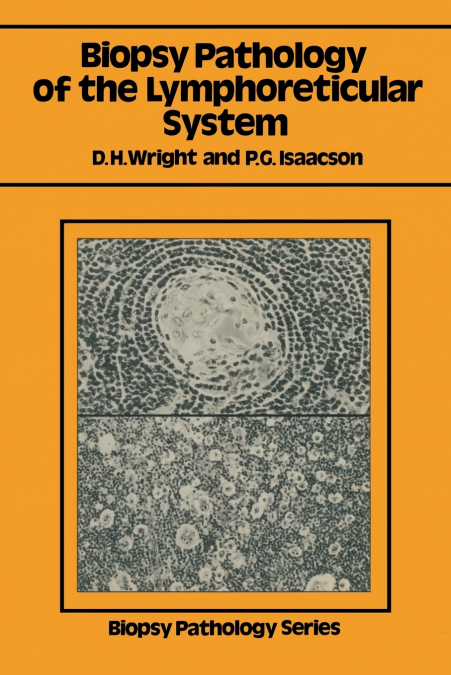 Biopsy Pathology of the Lymphoreticular System