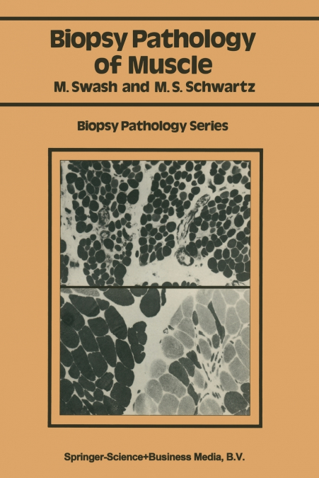 Biopsy pathology of muscle
