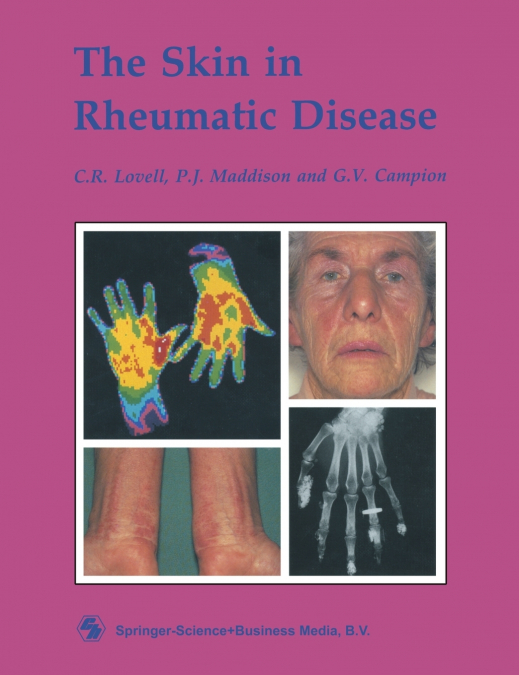 The Skin in Rheumatic Disease