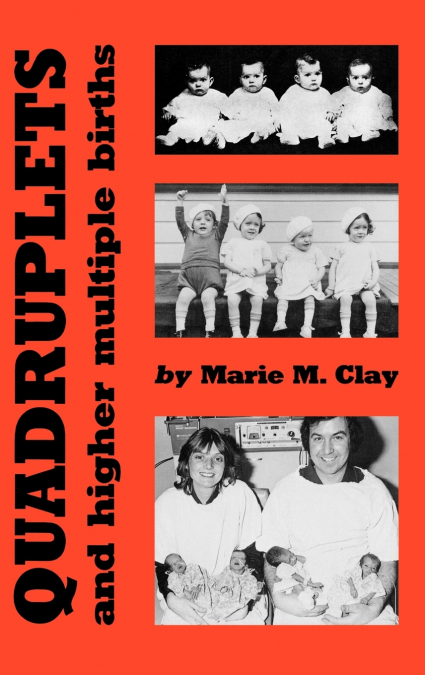 Quadruplets and Higher Multiple Births