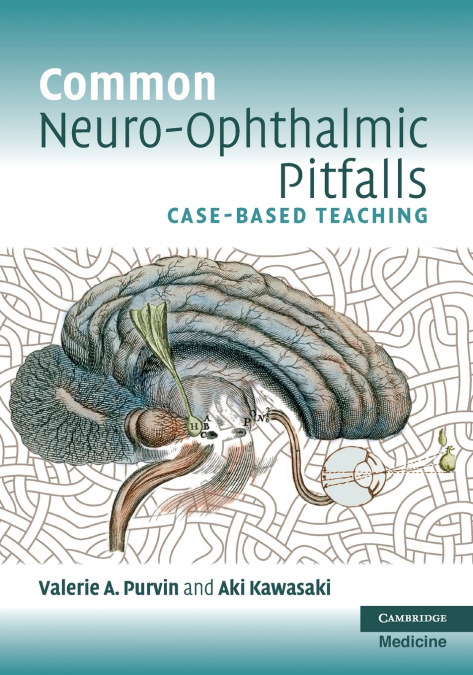 Common Neuro-Ophthalmic Pitfalls
