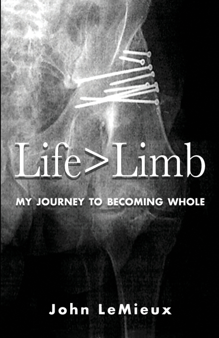 Life is Greater Than Limb