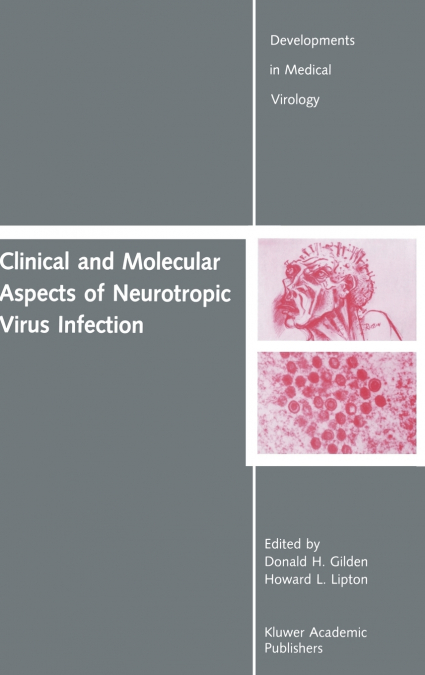 Clinical and Molecular Aspects of Neurotropic Virus Infection