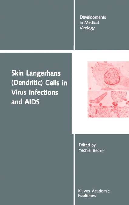 Skin Langerhans (Dendritic) Cells in Virus Infections and AIDS