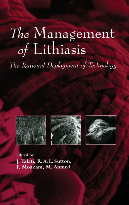 The Management of Lithiasis
